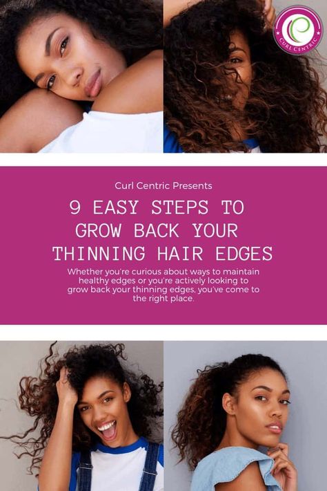 9 Easy Steps to Grow Back Your Thinning Hair Edges (i.e., Baby Hair) Grow Baby Hair, Regrow Edges, Easy Edges, Hair Steps, Curly Hair Regimen, Curly Hair Growth, Thinning Edges, Hair Edges, Acne Facial Wash