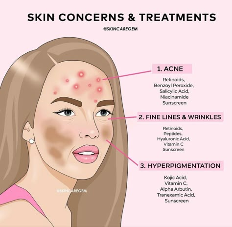 Cosmetic Making, Skincare Recommendations, Skin Advice, Skin Care Routine Order, Basic Skin Care, Clear Healthy Skin, Basic Skin Care Routine, Clear Skin Tips, Perfect Skin Care Routine