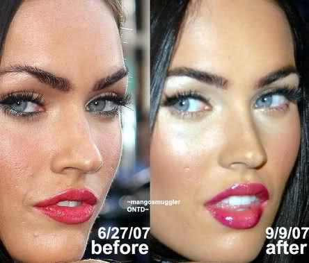 Fox Nose, Meghan Fox, Facelift Without Surgery, Filler Lip, Botox Before And After, Hair Implants, Lipstick For Fair Skin, Celebrity Plastic Surgery, Lip Enhancement