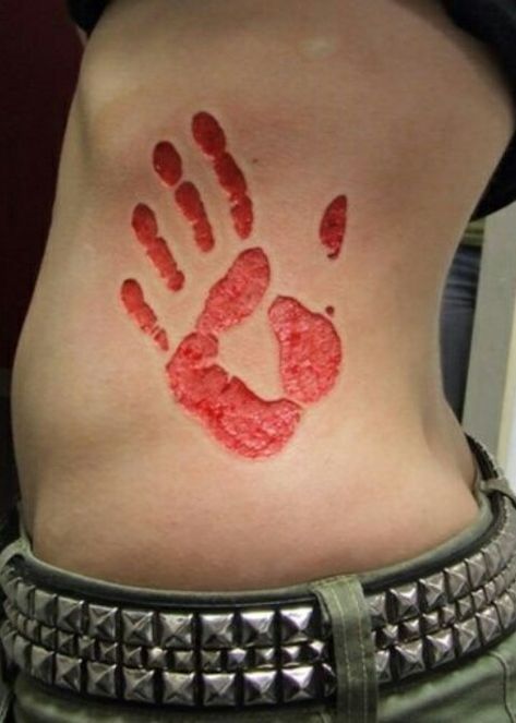 Supernatural Tattoo Castiel Handprint! Supernatural Handprint, Tattoos That Look Like Scars, Castiel Handprint Tattoo, Wound Tattoo Ideas, Tattoo Ideas Supernatural, Scarification Tattoo Healed, Castiel Tattoo Ideas, Scp Tattoo, Scarification Tattoo Ideas