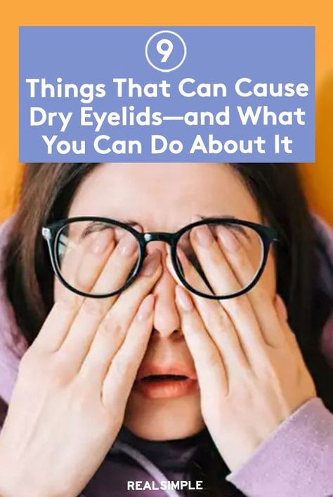 What can cause dry, flaky eyelids—and how do you treat them? Dermatologists are here to explain. Dry Eye Lids, Dry Skin Around Eyes Remedies, Eyelid Irritation Remedies, Crepey Eyelids Remedy, Eyelid Excema, Dry Eyes Remedy How To Get Rid, Dry Eyelids Remedy, Dry Flaky Eyelids, Dry Skin Around Eyes