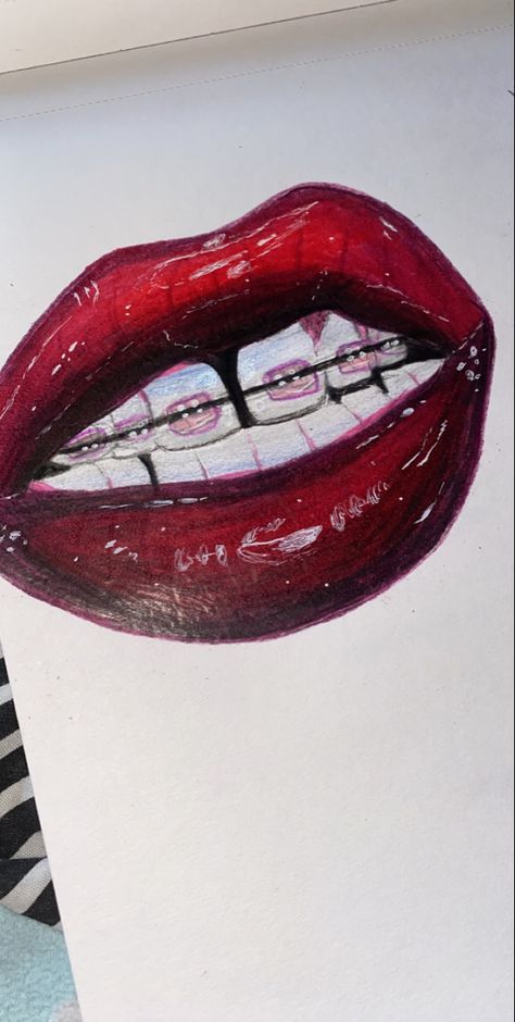 Mouth With Braces Drawing, Braces Drawing, Lip Reference, Open Mouth Drawing, Mouth Painting, Dentist Art, Teeth Drawing, Collage Pics, Rainbow Lips