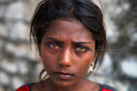 The Gypsy Girl with two different eye colors | by Thanwan Singh Two Different Eye Colors, Pushkar Mela, Heterochromia Iridum, Different Eye Colors, Heterochromia Eyes, Marilyn Monroe Art, Bald Women, Unique Faces, Magic Eyes