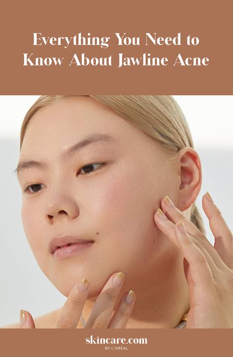 woman toughing her face, with title to read everything you need to know about jawline acne Jawline Acne How To Get Rid Of, Jawline Acne Causes, Acne On Jawline Meaning, Jawline Acne, Pregnancy Acne, Prevent Pimples, Acne Help, Face Care Routine, Natural Acne Remedies