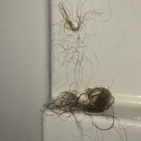 Are you shedding hair more than normal? Does your shower look like this? Half of all women will experience hair loss in their lifetime due to stress, hormone imbalance, pregnancy, surgery, and autoimmune disease. Let Virtue Flourish help support your regrowth journey. Simple and medically proven to regrow you hair. Independent testing labs said 90% saw more growth. 97% had healthier scalps, 90% had more volume. Hair Shedding, Healthy Scalp, Hormone Imbalance, Maximalism, Autoimmune Disease, Hair Tips, The Valley, Hair Hacks, Surgery