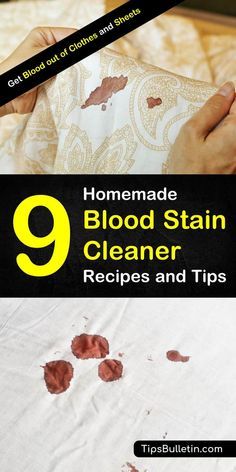 Blood Out Of Clothes, Stain Cleaner, Off Wallpaper, Homemade Toilet Cleaner, Clean Baking Pans, Cleaning Painted Walls, Cleaner Recipes, Deep Cleaning Tips, Stain Removal