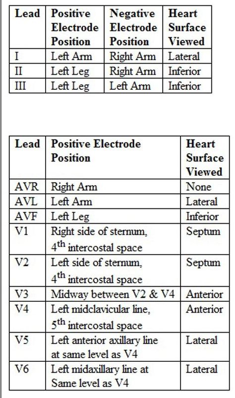 12 Lead Ekg Placement, Ecg Placement, Ekg Placement, Lead Placement, Ekg Technician, Emt Study, Cardiology Nursing, Ekg Interpretation, Medical Assistant Student