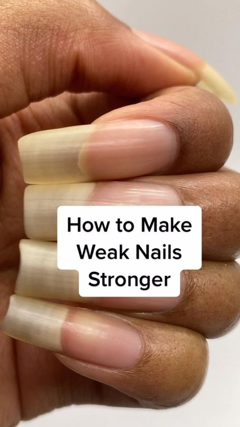 Nails Stronger, Grow Long Nails, Nail Growth Tips, Sunburn Remedies, Weak Nails, Nail Care Tips, Nail Care Routine, How To Grow Nails, Brittle Nails