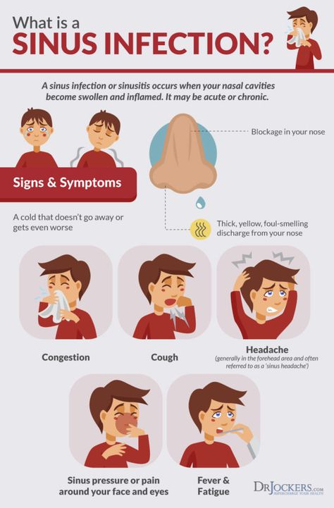 Sinus Headache, Nasal Cavity, Sinus Pressure, Sinus Congestion, Sinus Infection, Workout Chart, Good Health Tips, Protein Snacks, Health And Fitness Tips