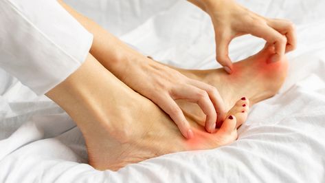 Itchy Feet At Night, Skin Fungus, Female Hands, Stomach Issues, White Bed, Nerve Damage, Bug Bites, Neurological Disorders, Skin Disorders