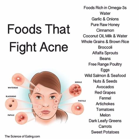 Acne Safe Foods, Clear Skin Care, Haut Routine, Skin Advice, Basic Skin Care, Face Skin Care Routine, Good Skin Tips, Basic Skin Care Routine, Clear Skin Tips