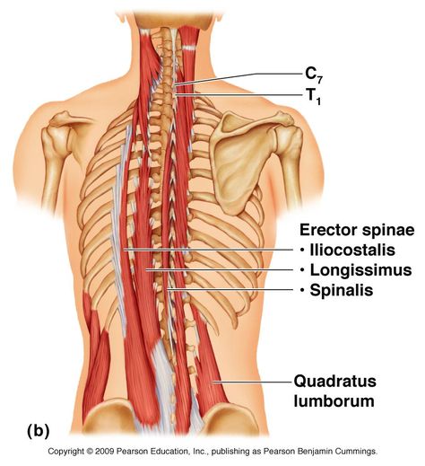 Erector Spinae Muscles Erector Spinae Muscles, Back Muscles Anatomy, Thoracic Cage, Anatomy Muscles, Erector Spinae, Quadratus Lumborum, Muscles Of The Neck, Vertebral Column, Lower Back Muscles