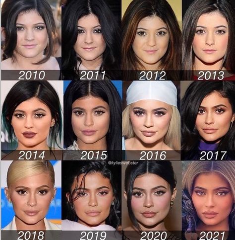 Kylie Jenner on Instagram: “The glow up #kuwtk #kuwtkclips #kardashiankollection #halloween #halloweenmakeup #halloweencostume #kyliejenner #kylijennerstyle…” Kylie Jenner Plastic Surgery, Cheek Implants, Tag Your Best Friend, Kylie Kardashian, Chin Augmentation, Botox Lips, Wardrobe Fashion, Celebrity Plastic Surgery, The Glow Up