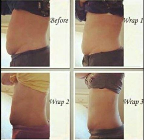 Amazing results It Works Body Wraps, Castor Oil For Skin, It Works Wraps, Natural Skin Tightening, Skin Tightening Mask, Skin Tightening Stomach, It Works Products, Crazy Wrap Thing, Body Detox