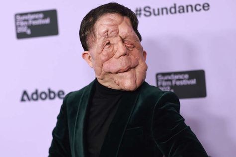 “Why are non-disabled people writing about disability without consultation?” the British actor said Said Writing, Knooking Tutorial, Facial Reconstruction Surgery, Adam Pearson, Disabled People, Sundance Film Festival, Stage Play, Matthew Mcconaughey, Sports Videos