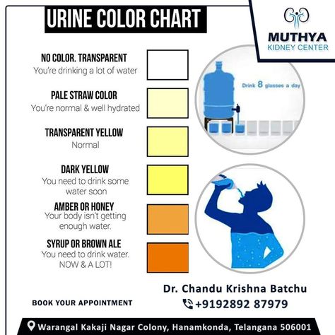 Color Of Urine Meaning, Urine Color Chart, Color Of Urine, Urine Color, Kidney Pain, Health Chart, Self Advocacy, Nursing School Notes, Water Intake