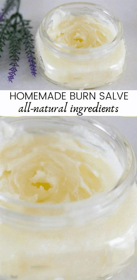 Burn Salve, Our Oily House, Burn Ointment, Salve Recipes, Healing Salves, Cold Sores Remedies, Cleaner Recipes, Natural Sleep Remedies, Natural Cold Remedies