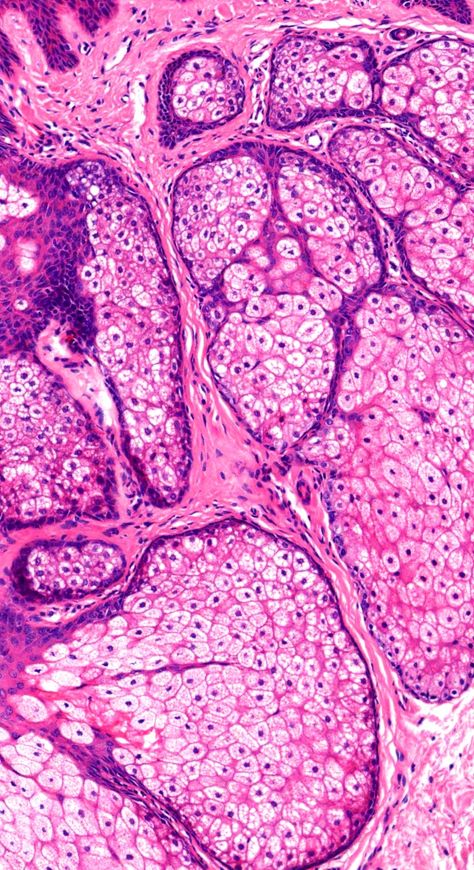 Histology Wallpaper, Pathology Wallpaper, Sassy Backgrounds, Histology Aesthetic, Pathology Aesthetic, Biology Background, Sebaceous Hyperplasia, Anatomy Images, Biology Major