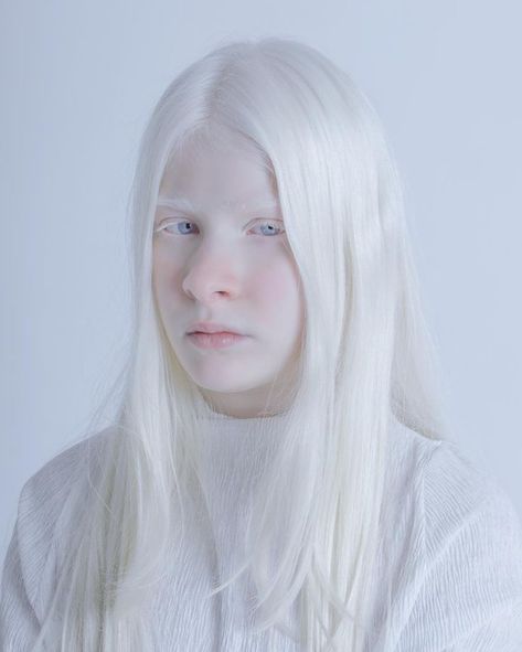 Albino Skin, Albino Rabbit, ليلي كولينز, Albino Girl, Coquette Girl, Platinum Hair, Aesthetic People, Face Photo, Beauty Standards