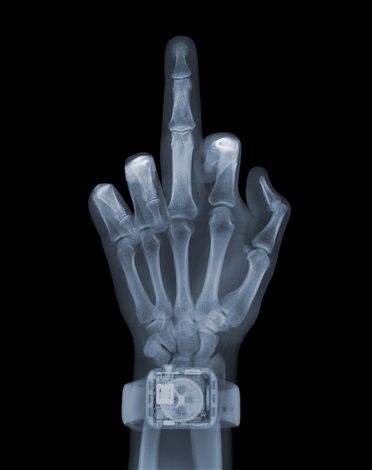 Nick Veasey's X-ray Art: See Things as They Really Are - Arte & Lusso Vincent Black Shadow, Xray Art, X-ray Images, Photography Artists, Photography Inspiration Nature, X Rays, Art Street, Abstract Photography, Contemporary Art Gallery