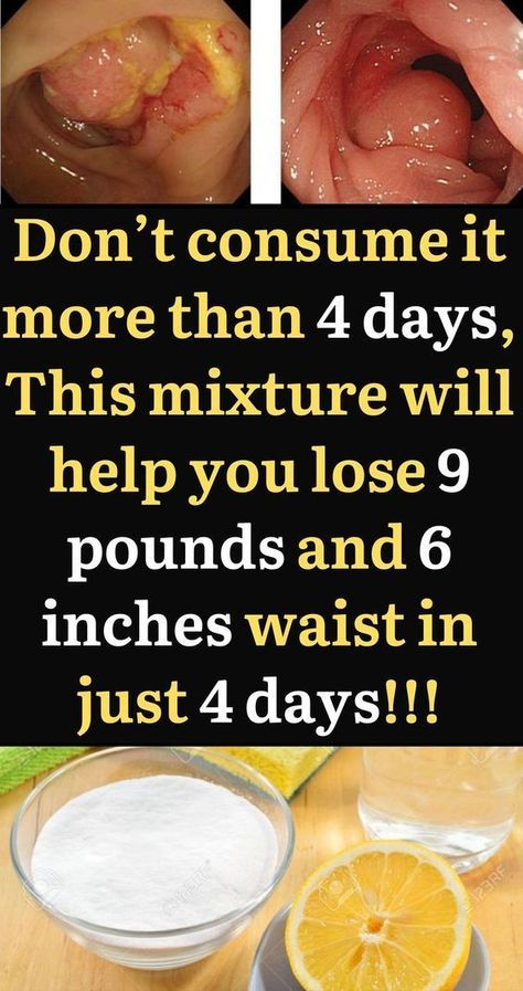 weight loss tips for women, easy diet to follow, easy diet to lose weight, easy diet for weight loss #weightloss #diet #loseweight #howtoloseweight Healthy Workout, Workout Diet, Stubborn Fat, Losing 10 Pounds, Gym Fit, Diet Pills, Fat Fast, 10 Pounds, Health Healthy