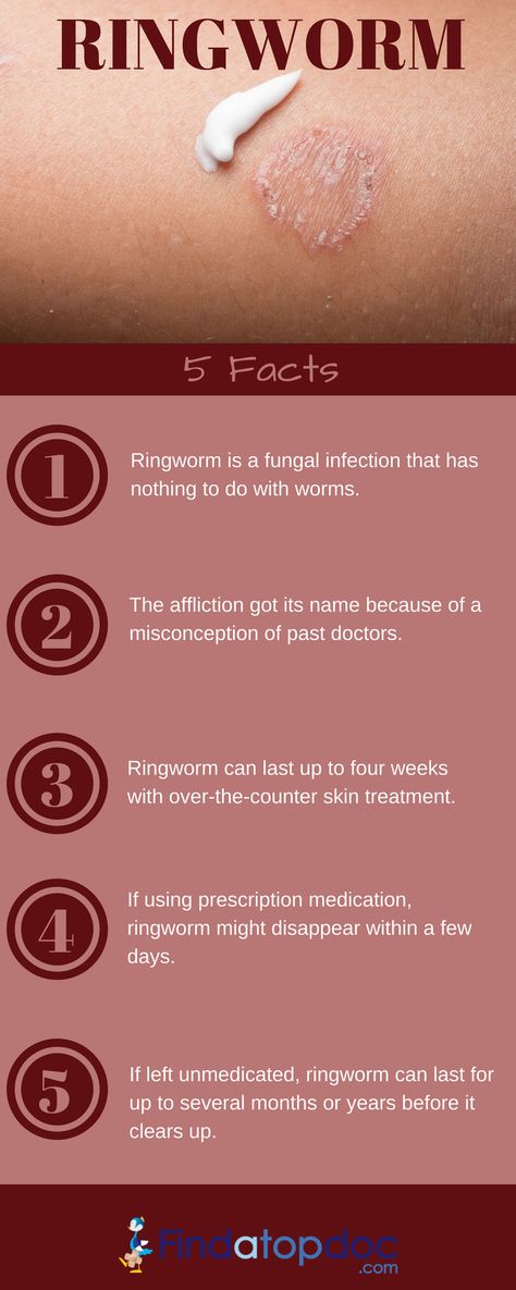 infection is caused by a fungus, not a worm. Ringworm infection can affect both humans and animals Ringworm is a fungal infection of the skin. The name “ringworm” is a misnomer, since the. Ringworms In Humans, Skin Fungus, Home Remedies For Sinus, Fungal Infection Skin, Natural Remedies For Migraines, Health Chart, Humans And Animals, Dry Skin Remedies, Healthy Lifestyle Quotes