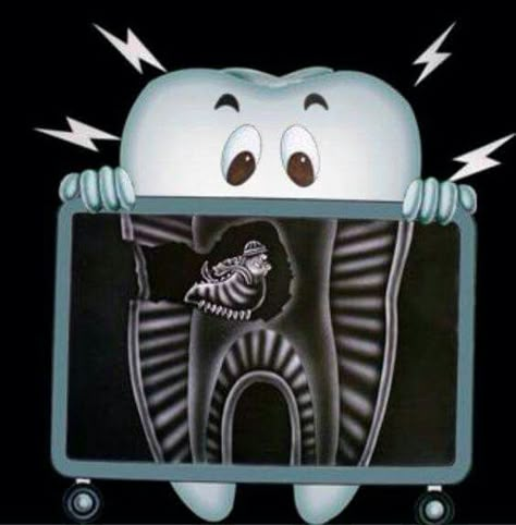 Tooth Art, Dental Advertising, Dental World, Dental Posts, Dental Posters, Dental Jokes, Dental Assisting, Dental Implants Cost, Dental Hygiene School