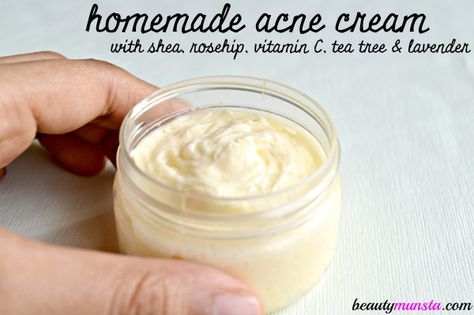 Why not make your own homemade cream for acne and pimples using all natural ingredients that are miracle healers for acne? So many products that claim to cu Acne Cream Diy, Natural Remedies For Pimples, Cream For Acne, Natural Beauty Hacks, Diy Face Cream, Pimple Cream, Natural Face Cream, Homemade Face Cream, Pimples Remedies