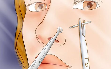 14 Tips on How to Pierce Your Own Nose- or grab an ice cube and shove that fucker through like I did Piercing Your Own Nose, Nose Piercing Diy, Nose Piercing At Home, Self Piercing Diy, Diy Nose Piercing, Nostril Piercing Placement, How To Pierce Your Nose At Home, Nose Piercing Stud Placement, Piercing Tips