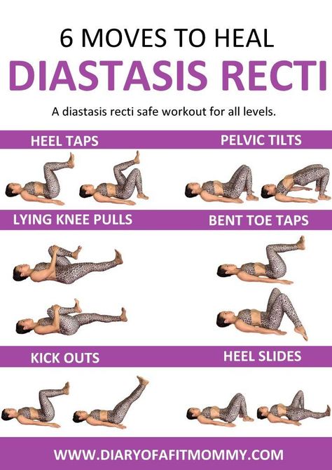 Heal and repair your Diastasis Gap at home with this workout. These exercises are gentle for the postpartum core. Recti Diastasis, Heal Diastasis Recti, After Baby Workout, Healing Diastasis Recti, Post Baby Workout, Fitness Diary, Diastasis Recti Exercises, Post Pregnancy Workout, Latihan Yoga