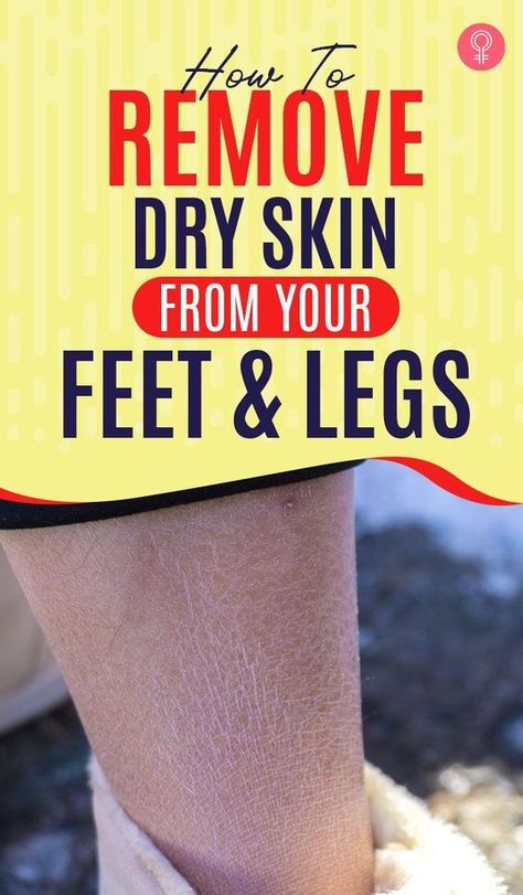 Board name Dryskin Skincare, Dry Legs, Home Remedies For Allergies, Dead Skin Removal, Dry Flaky Skin, Dry Skin Remedies, Scaly Skin, Home Remedies For Hair, Foot Soak