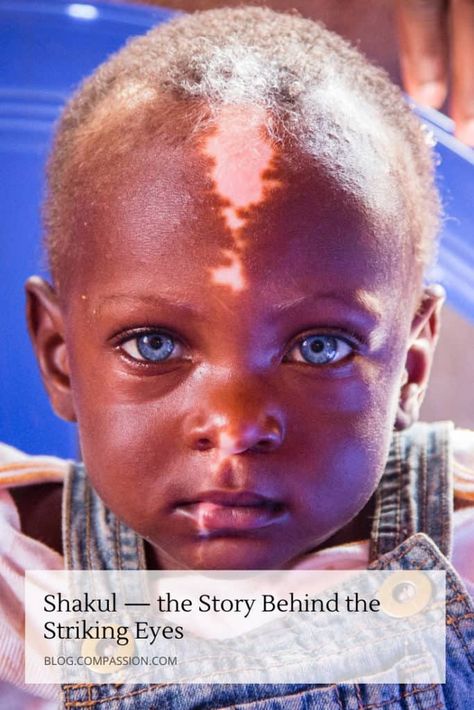 Shakul’s blue eyes are mesmerizing. But the story behind them will capture your hearts. Read this blog post to see how this little boy’s unique differences have affected his life – and how he inspires people in his Ugandan community each day. Waardenburg Syndrome, People With Blue Eyes, Special Needs Teacher, Rare Genetic Disorders, Blue Eyed Baby, Compassion International, Sweet Hug, Different Colored Eyes, Pen Art Work