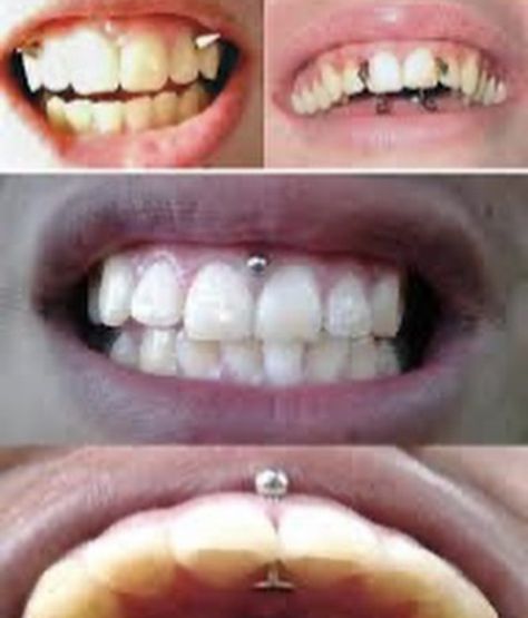 Gum Piercing, Piercing Mouth, Linear Tattoo, Piercing Bump, Piercing Bouche, Mouth Piercings, Best Tattoo Ever, Body Necklace, Types Of Piercings