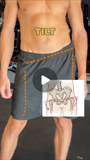 MaxiMove on Instagram: "Lateral Pelvic Tilt >> Kinetic Chain Misalignment This routine addresses the long leg. Mainly, focusing on Frontal pelvic push, Arch activation and hip ability to stabilize." Lateral Pelvic Tilt, Legs Exercise, Hip Exercises, Dj Premier, Pelvic Tilt, Leg Chain, Hip Workout, Leg Workout, Body Health