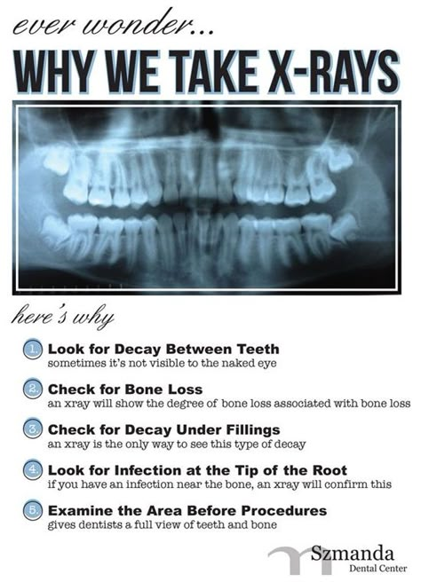 Dentaltown - Have you ever wondered why we take x-rays? Wonder no more. Dental Assistant Study, Dental Ideas, Dental Hygiene Student, Dental World, Dental Education, Dental Posts, Dental Assisting, Dental Hygiene School, Dental Anatomy