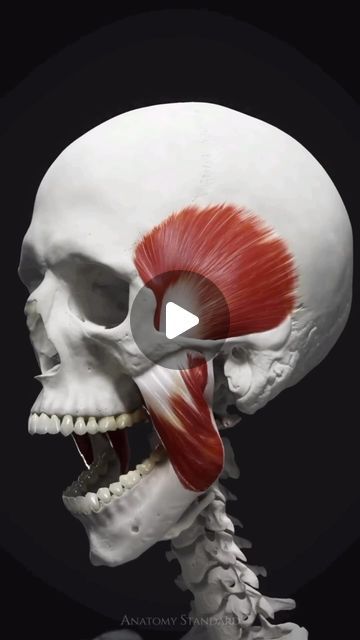 Dental Mentor Pro ®️ on Instagram: "🌟The primary muscles of mastication are the group of muscles responsible for the movement of the jaw during chewing (mastication). There are four main muscles involved in this process: 1️⃣ Masseter: This is the most powerful muscle of mastication. It is a thick, strong muscle that originates from the zygomatic arch (cheekbone) and inserts into the angle and ramus of the mandible (lower jaw). It elevates and closes the jaw during chewing. 2️⃣ Temporalis: This muscle is located on the sides of the skull and originates from the temporal bone. It inserts onto the coronoid process of the mandible. The temporalis muscle is responsible for closing the jaw and retracting the mandible (pulling it backward). 3️⃣ Medial Pterygoid: This muscle is situate Temporalis Muscle, Jaw Angle, Buccal Massage, Temporal Bone, Masseter Muscle, Jaw Muscles, Acupuncture Clinic, Muscle Power, Jaw Bone