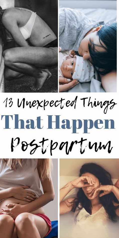 Pregnancy Hacks, Pregnancy Info, Pregnancy Information, Baby Sleep Problems, Baby Prep, Postpartum Care, Postpartum Recovery, Baby Arrival, Post Baby