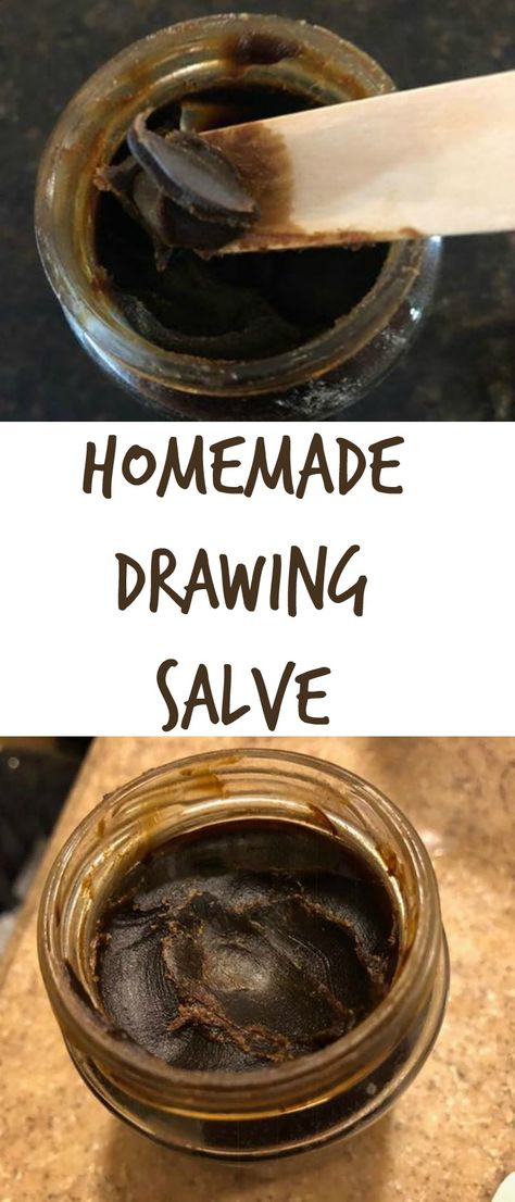 This drawing salve works and lasts forever (well, almost). Just a smidgin' will do - and the culprit will be gone. Diy Drawing Salve, Drawing Salve Recipe, Drawing Salve, Herbal Remedies Recipes, Salve Recipes, Diy Drawing, Herbal Salves, Herbal Recipes, Natural Healing Remedies