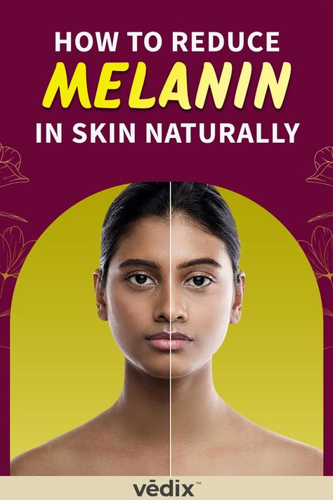 How To Reduce Melanin In Skin Naturally Naturally Brighten Skin, Melanin Reducing Tips, How To Decrease Melanin In Skin, How To Reduce Melanin In Skin Naturally, How To Brighten Skin Naturally, How To Reduce Melanin In Skin, Dull Skin Remedies, Remedies For Hyperpigmentation, Imbalanced Hormones