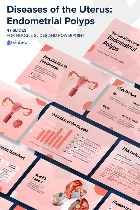 Diseases of the Uterus: Endometrial Polyps Endometrial Polyps, Pink Illustration, Medical Posters, Powerpoint Backgrounds, Power Point Template, Medical Health, Google Slides Themes, Slide Design, Microsoft Powerpoint