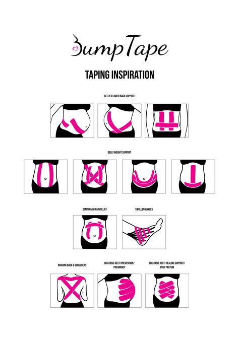 Safe Medicine While Pregnant, Taping Pregnant Belly, Kt Tape For Pregnant Belly, Kt Tape Pregnancy, Pregnant Tips, Pregnancy Back Pain, Pregnancy Ideas, Pregnancy Hacks, Kt Tape