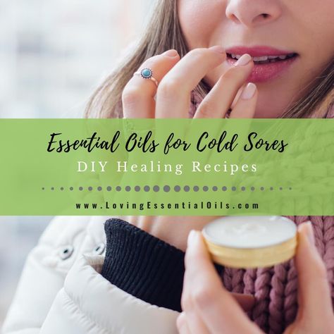 Essential Oils for Cold Sores on Lip with DIY Recipe Blends Canker Sore Remedies Essential Oils, Essential Oil For Cold Sore, Essential Oils For Cold Sores, Cold Sore Essential Oil, Cold Sore Lip, Essential Oil Blends For Colds, Essential Oils For Cold, Lemon Balm Oil, Lemon Balm Essential Oil