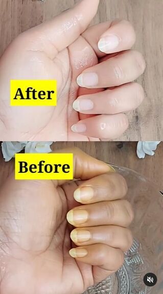 This guide shares a hack for turning yellow nails white. Learn how to whiten nails in this step-by-step tutorial. Diy Nail Whitener, How To Get Whiter Nails At Home, How To Get Nails White, How To Whiten Fingernails, How To Clean Yellow Nails, Get Rid Of Yellow Nails, How To Whiten Yellow Nails, How To Whiten Nails Naturally, How To Whiten Nails Diy At Home