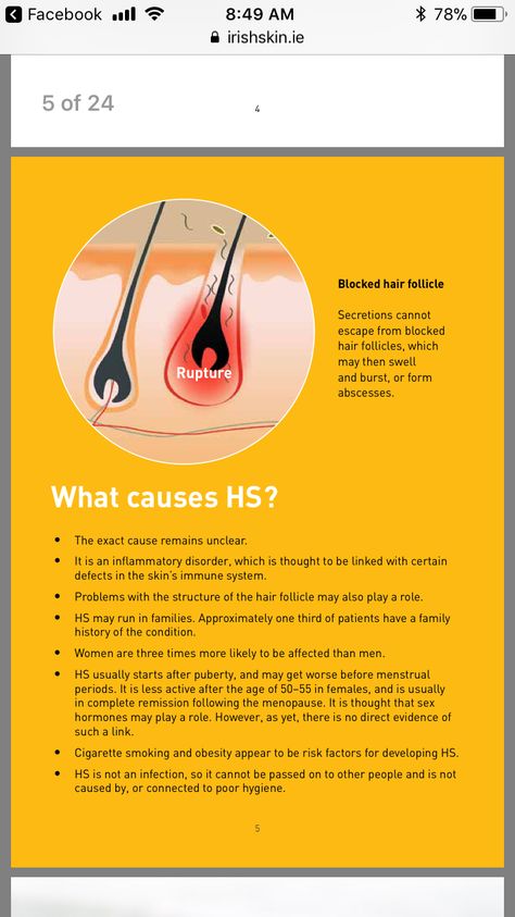 Hs Skin Disease Natural Remedies, Hidranitis Suppurativa, Hs Treatments, Hs Skin Disease, Hs Remedies, Hidradenitis Remedies, Hs Disease, Hs Diet, Hs Awareness