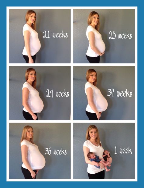 Twin pregnancy progression Twins Maternity Photoshoot, Twins Belly, Twin Bump Progression, Twins Pregnancy, Twins Pregnancy Belly, Pregnancy Progress Pictures, Twin Maternity Photos, Twin Pregnancy Symptoms, Twin Belly