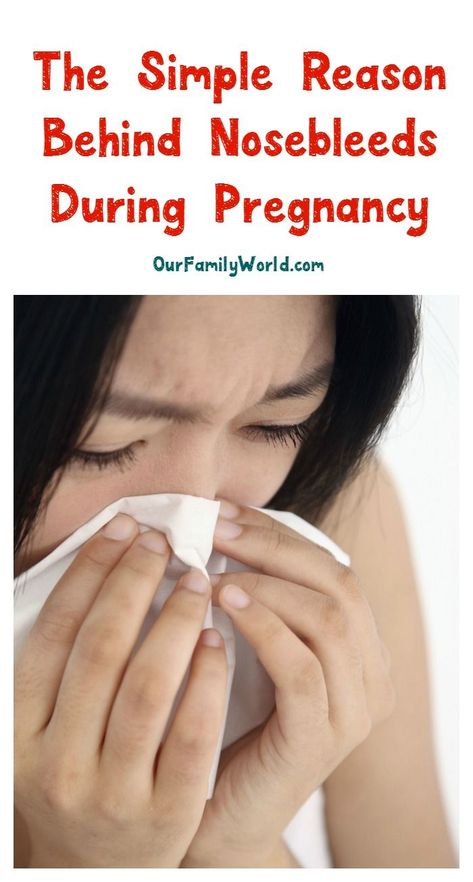 What causes nosebleeds during pregnancy? Find out the super simple reason behind your nose's revolt against you & how you can prevent it! Pregnancy Calculator, Nose Bleeds, Pregnancy Art, Mood Lifters, I'm Pregnant, Trying To Conceive, Pregnancy Stages, Weird Stuff, Talking To You