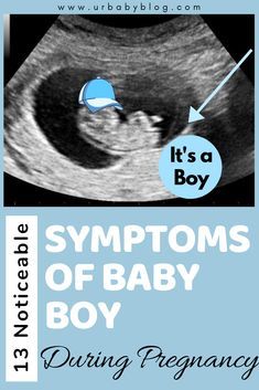 Gender Reveal Boy Announcement, Baby Boy Ultrasound Pictures, It’s A Boy Pregnancy Announcement, Boy Or Girl Prediction Signs, We Are Pregnant Announcement, Baby Boy Gender Announcement, Gender Announcement Pictures, Monthly Pregnancy Pictures, Boy Vs Girl Pregnancy