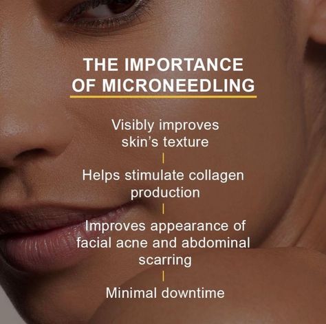 Micro Needling Before And After, Microneedling Before And After, Microneedling Benefits, Skinpen Microneedling, Microneedling Pen, Laser Facial, Laser Hair Reduction, Facial Therapy, Aesthetic Nurse