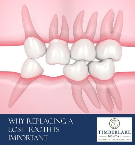 Lost Tooth, Patient Education, Oral Health, The Space, You Really, Lost, Health