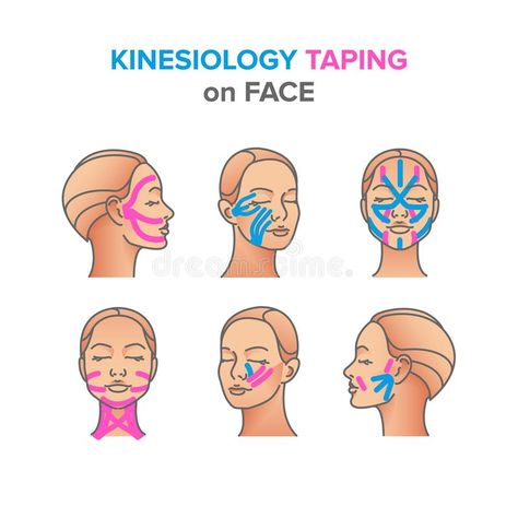 Kinesiology taping illustrations on face royalty free illustration Face Taping, Physio Tape, K Tape, Tape Face, Sports Massage Therapy, Double Menton, Kinesio Taping, Kinesiology Taping, Muscle Anatomy